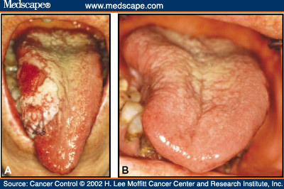 http://www.medscape.com/content/2002/00/44/25/442595/art-cc442595.fig1.jpg