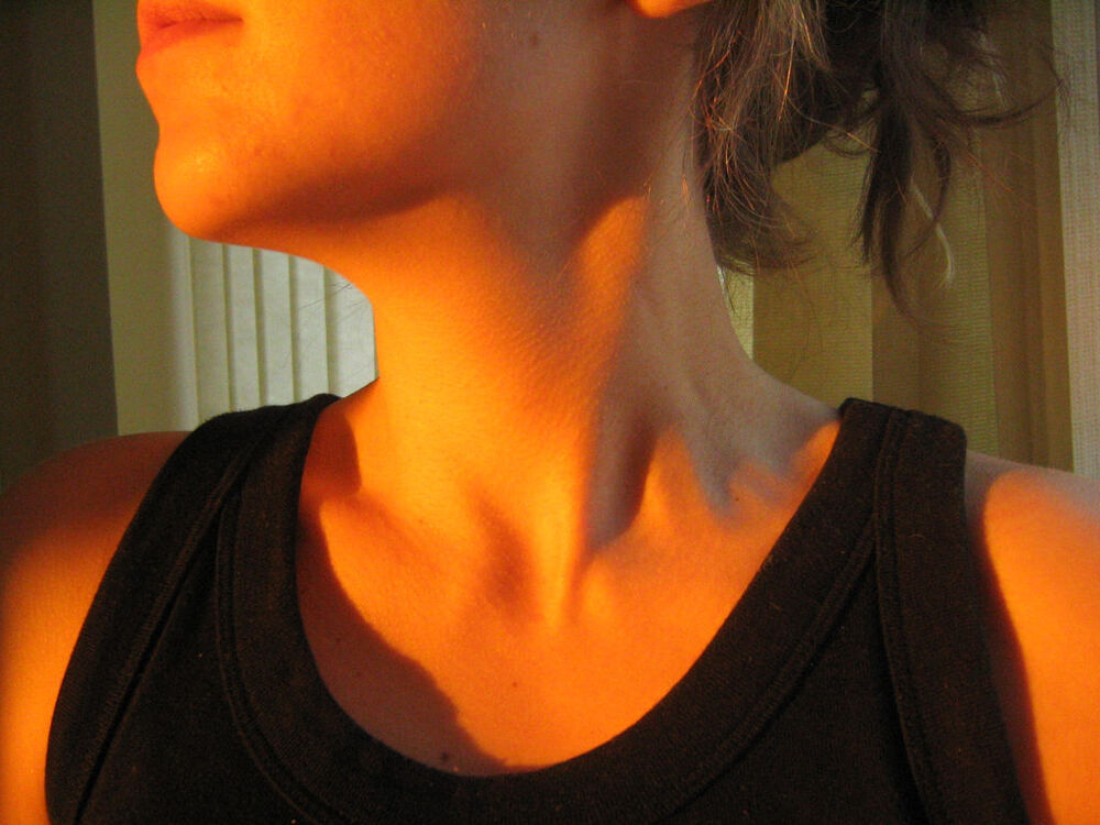 http://upload.wikimedia.org/wikipedia/commons/archive/9/99/20070102222232!Female_neck.jpg