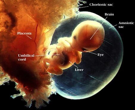 http://www.babybytes.nl/images/week8-fetus-in-amnionic-sac.jpg